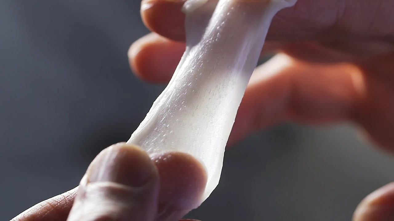 Hands stretching a collagen matrix skin replacement