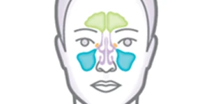 Sinus Cavity Illustration