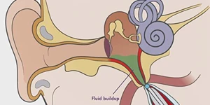 Illustration of the inner ear